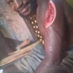 MIX: Victims of Papuan tribal wars