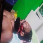 Man killed as two families clash with machetes and arrows
