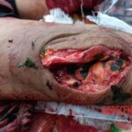 Mass brawl leaves several injured