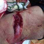 Mass brawl leaves several injured