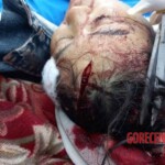 Mass brawl leaves several injured