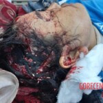 Mass brawl leaves several injured