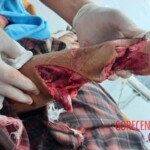 Mass brawl leaves several injured