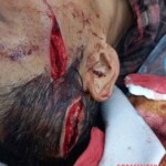 Mass brawl leaves several injured