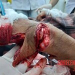 Mass brawl leaves several injured