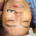 Stabbed Chinese woman in morgue