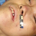 Stabbed Chinese woman in morgue
