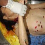 Stabbed Chinese woman in morgue