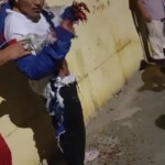 Teen extortionist injured by his own explosive device