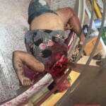 Woman after falling from 15th floor