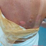 Woman scalded with hot water by her abusive boyfriend